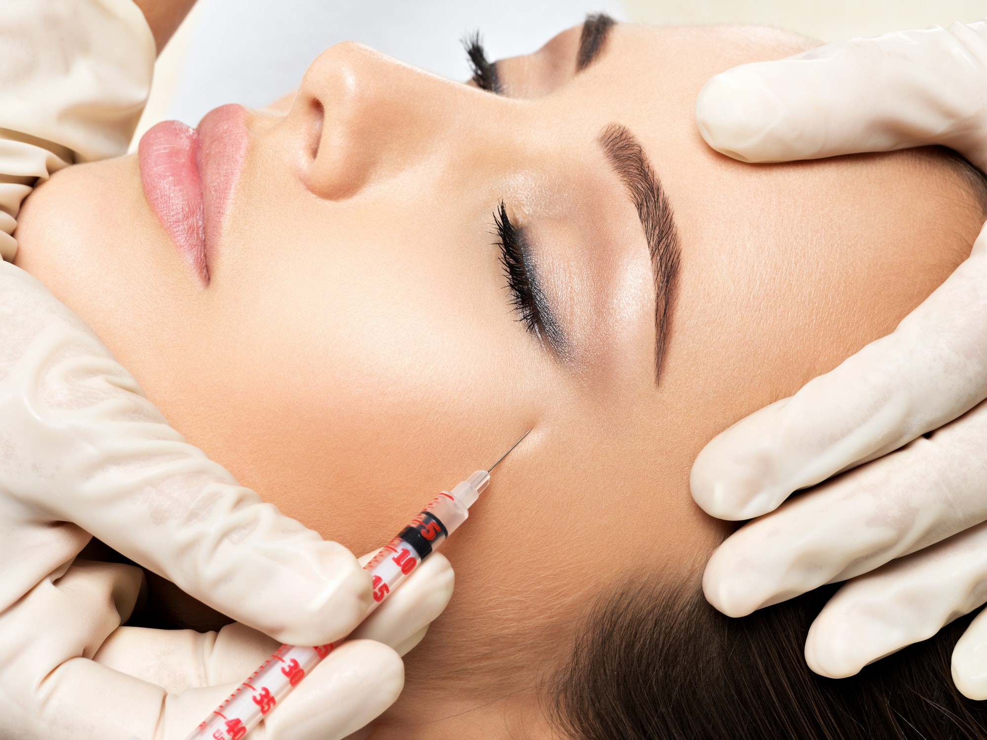Woman getting cosmetic injection of botox near eyes